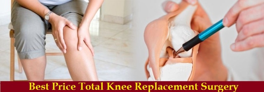 knee replacement surgery