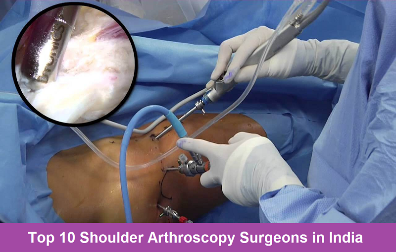 Top 10 Shoulder Arthroscopy Surgeons in India