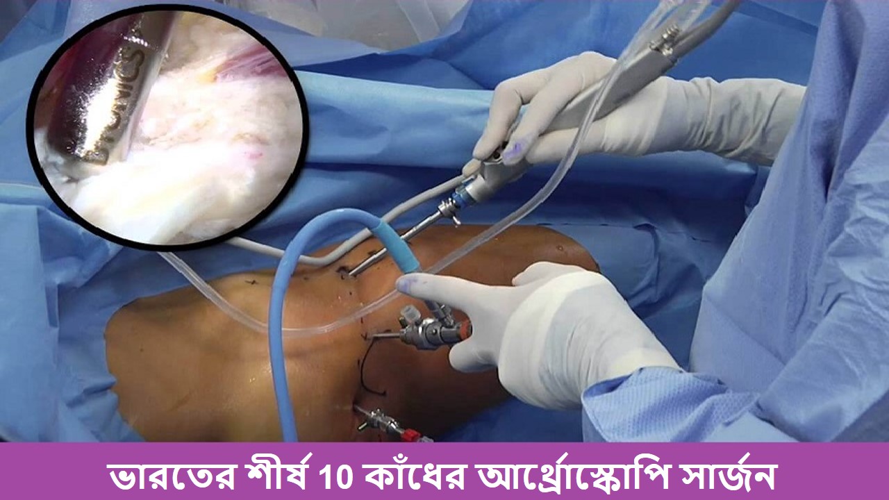 ভারতের সেরা শোল্ডার আর্থ্রোস্কোপি সার্জন