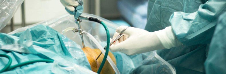 Joint and Replacement Surgery India