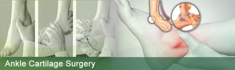 Low Cost Ankle Cartilage Surgery India