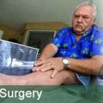 Low Cost Ankle Replacement In India