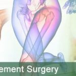partial knee replacement surgery