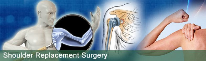 Low Cost Shoulder Replacement Surgery in India
