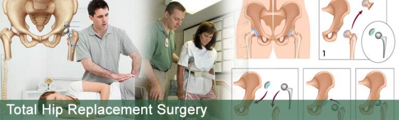 https://www.jointreplacementsurgeryhospitalindia.com/wp-content/uploads/2015/12/low-cost-total-hip-replacement-surgery-in-india.jpg