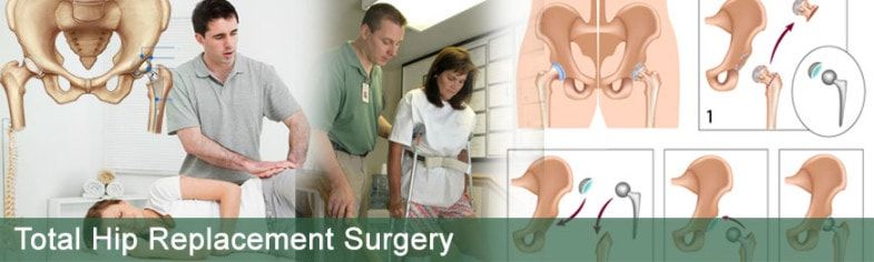 hip replacement surgery in india