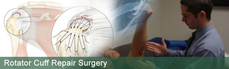 Rotator Cuff Surgery in India