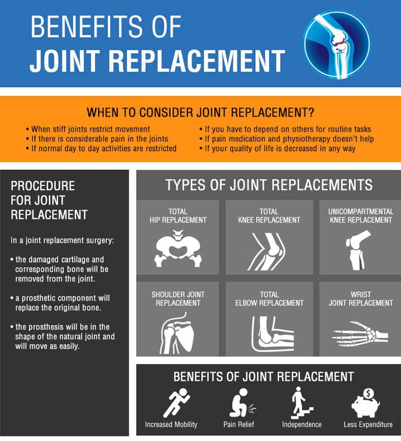 Benefits of Joint Replacement