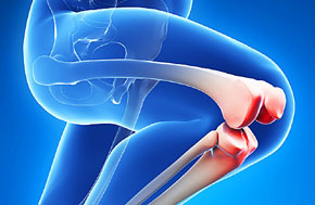 Joint Replacement Surgery in India