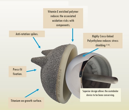 Key Benefits Polymotion Hip Resurfacing