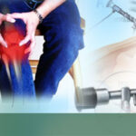 Low Cost Arthroscopy Surgery in India