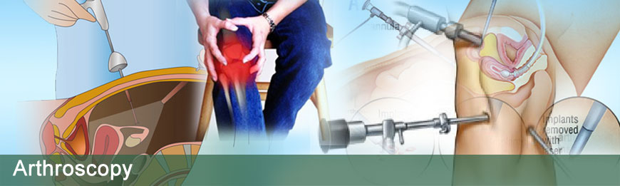 Low Cost Arthroscopy Surgery in India