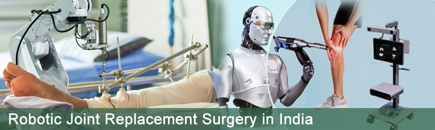 Affordable Robotic Joint Replacement Surgery in India